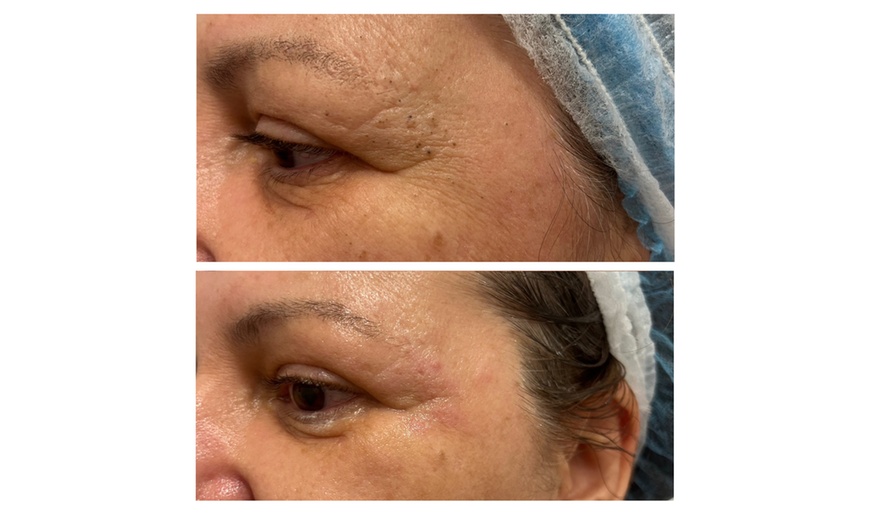 Image 11: Limpieza de cutis manual con tratamiento a elegir para 1 persona