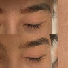 Image 1: Eyebrows Microblading & Tattoo Removal with Advanced Pico Laser