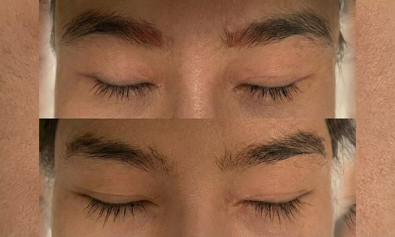 Achieve Clearer Brows: 1,2,or 3 Eyebrows Microblading-Tattoo Removal Sessions Using Pico Laser (Up to 59% Off) - Primary Image