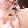 Image 3: 1, 2 o 3 sesiones de microlifting facial de vitaminas con Dermapen