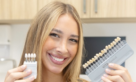 ZOOM Whitening Session in Office and a Comprehensive Dental Exam (Bitewing X-Rays, CBCT) - Upper Dental Hollywood