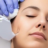Image 3: Hydrating Facial Mesotherapy in Central Soho
