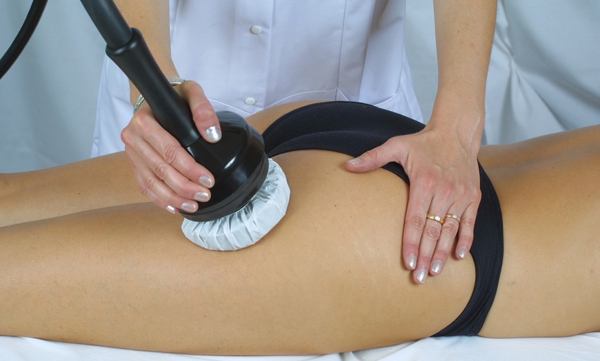 Image 1: 2, 4 o 6 sesiones de tratamiento reductor corporal con presoterapia