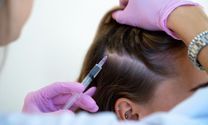 Image 6: Transform Your Hair with One or Three PRP Hair Restoration Sessions