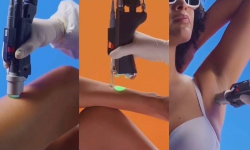 Image 2: Laser-Haarentfernung mit Alexandrit Motus Pro Laser an Zonen nach Wahl