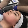 Image 1: Up to 73% Off on Facelift - Non-Surgical at California Trim Clinic Medical Weight Loss