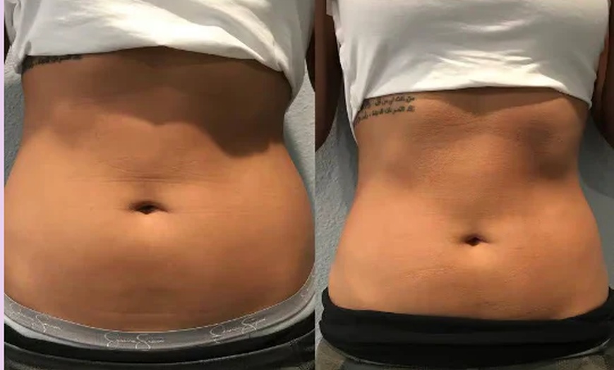 Image 2: Boost Recovery with Two, Four, Six, or Eight Cryotherapy Treatments