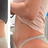 Image 4: Skin Tightening for Legs, Abs, Face Toning & Sculpting session/ More