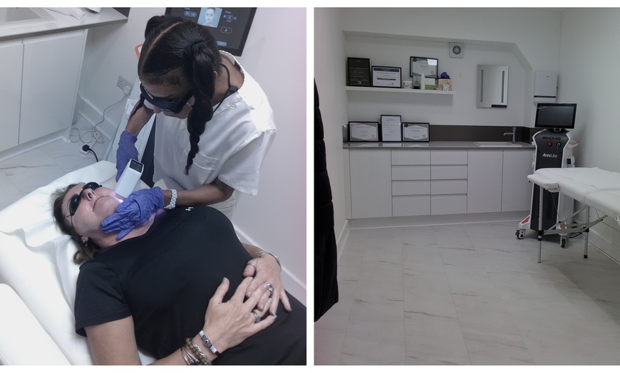 Image 1: Laser Hair Removal – 6 Sessions for Small to XL Areas
