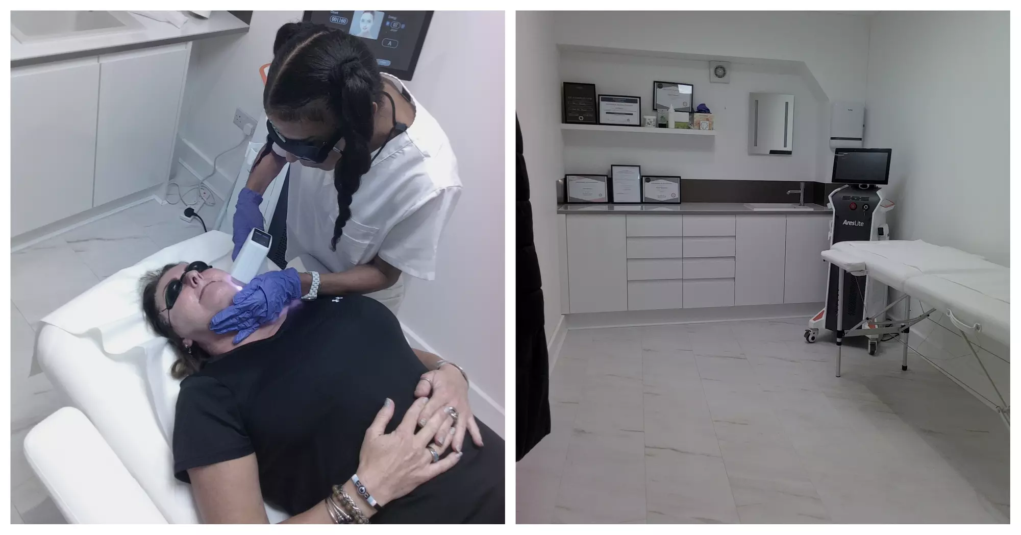 Laser Hair Removal – 6 Sessions for Small to XL Areas