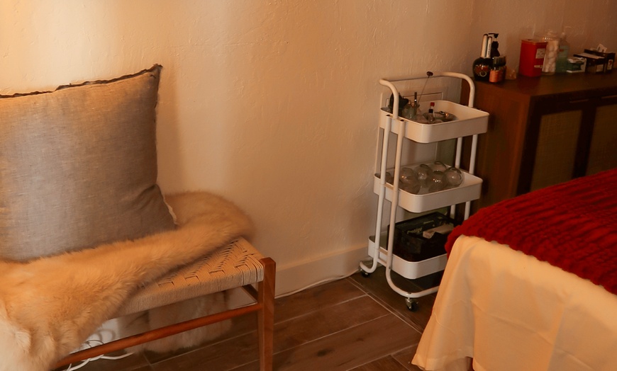 Image 6: Acupuncture, Facial Acupuncture & Cupping for Wellness & Relaxation