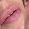 Image 3: Perfect Lips: Semi-Permanent Blush, Lip Liner & Dark Lip Correction