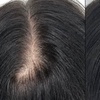 Image 3: Restore Confidence with Scalp Micropigmentation at Rose Beauty Bar