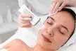 75-120 Min. Microneedling „Classic“ oder „Premium“ für 1 Person (bis zu 45% sparen) - Second Medium