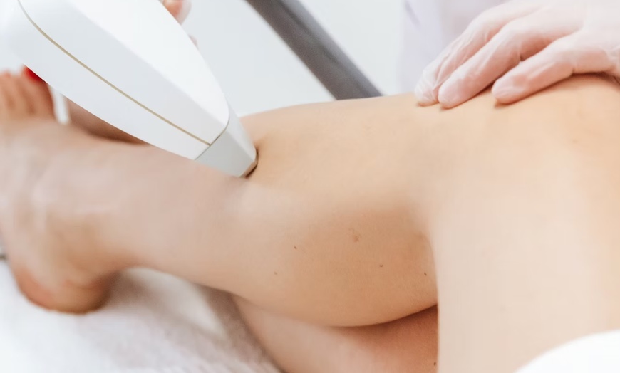 Image 1: Up to 50% Off on Soprano Laser Hair Removal at Luz Lounge Portland