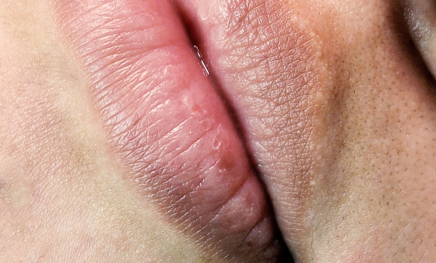 Image 3: Revitalize Your Lips with Hydra Gloss Lips or Glossyps