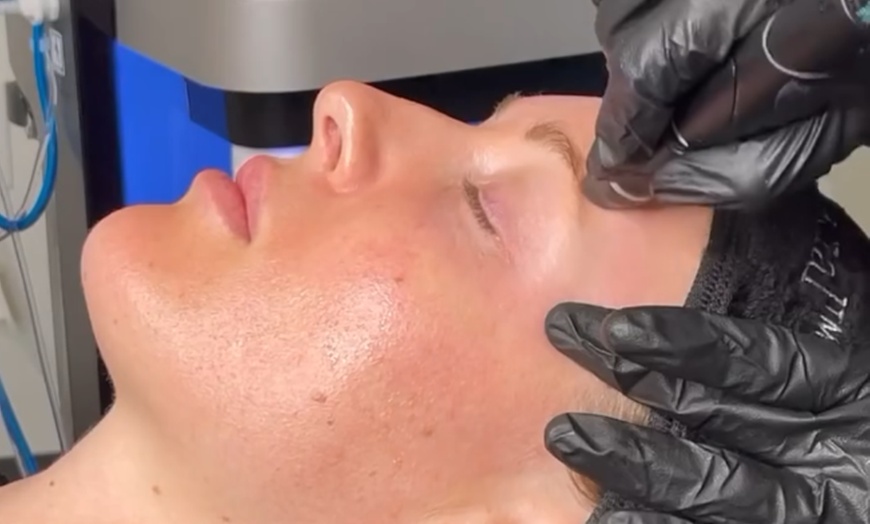 Image 1: Signature Hydrafacial at Belle Jeunesse!

