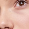 Image 3: Wrinkle Reduction on 2 or 3 Areas (Up to 3 Major & 1 or 2 Minor Areas)