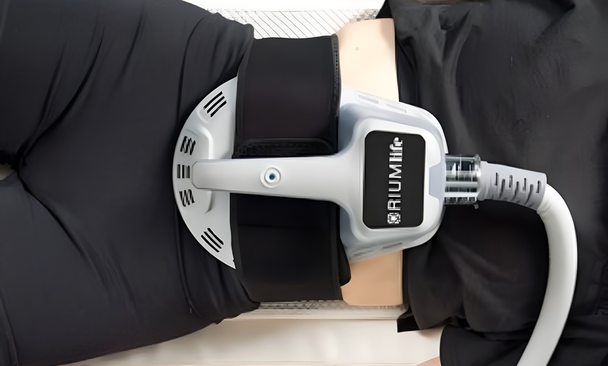 Image 3: EMS Sculpt: het effect van 20.000 sit-ups in één sessie