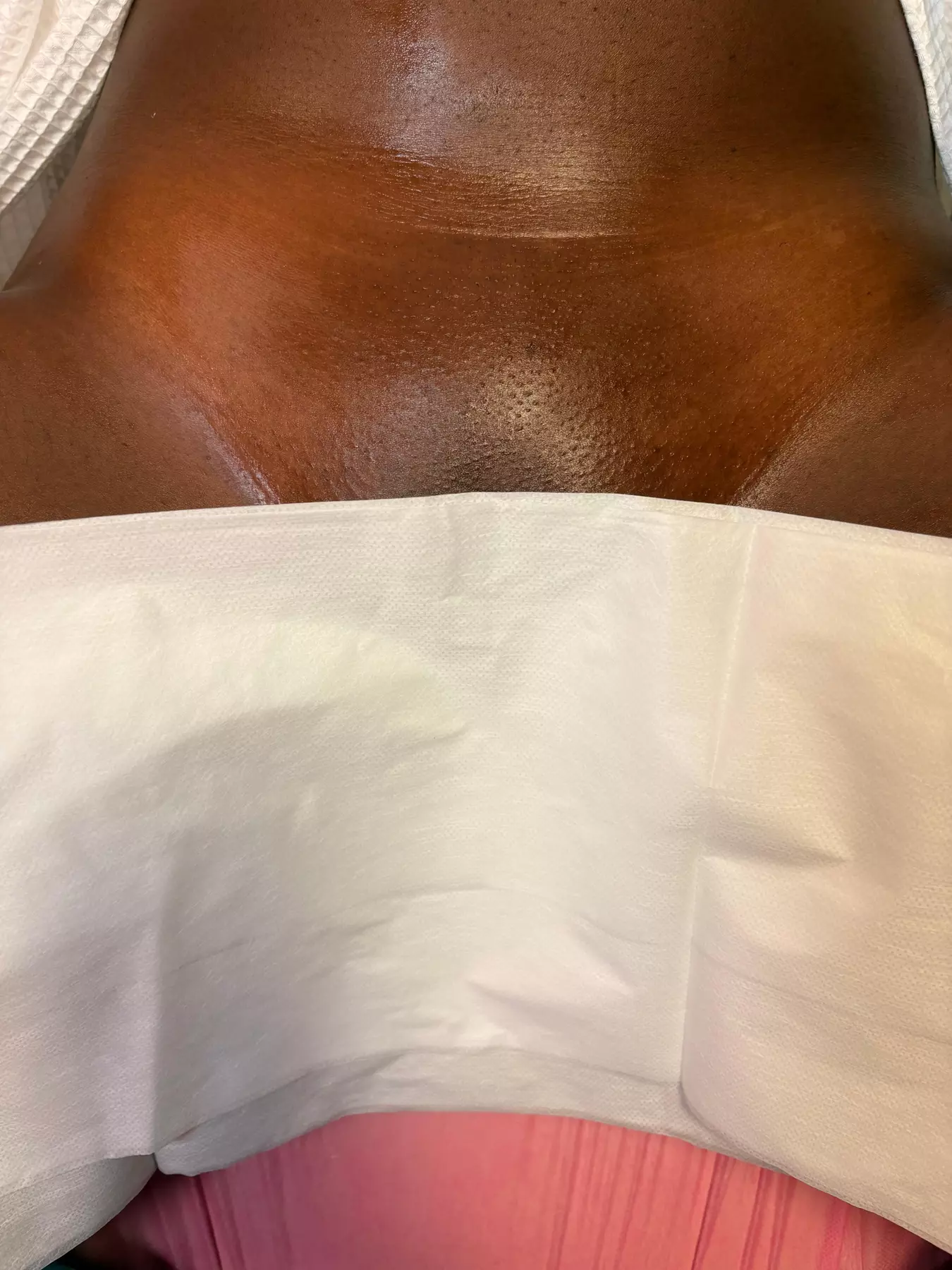 Experience Smoothness with 1, 3, or 5 Brazilian/Bikini Wax Options