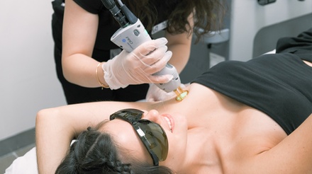 Six Laser Hair-Removal Sessions on Category A Area -- Valid Only at Grand Central Location - Bared Monkey - Grand Central