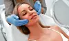 Avail a PDO Thread Lift Treatment for the Eyebrows((6-8 Threads), Lower/Full Face(10-12 Threads)(Up to 20% Off)