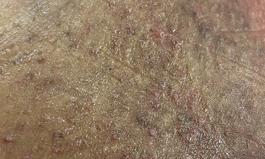 Image 4: One, Three, or Five Brazilian or Bikini Waxing Sessions Using Hard Wax