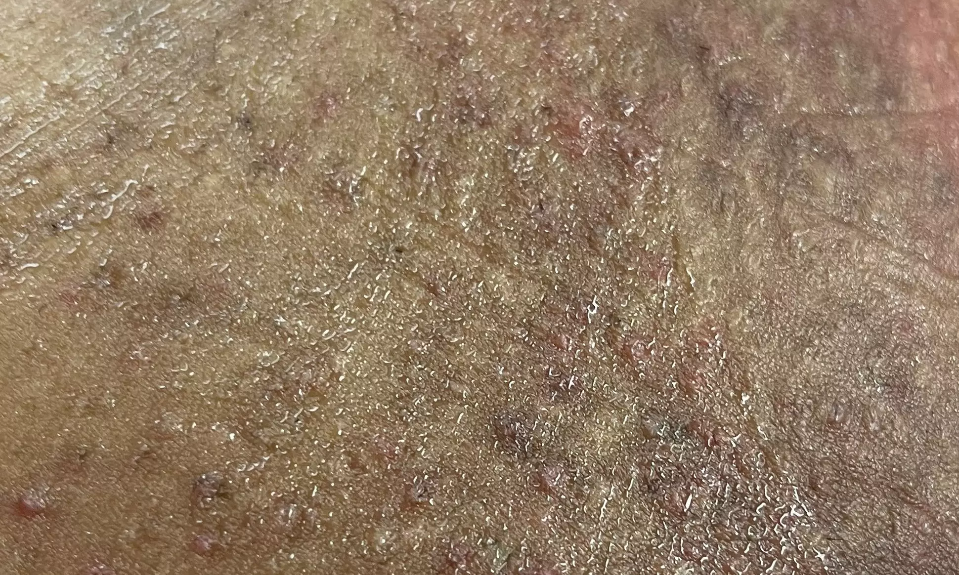 One, Three, or Five Brazilian or Bikini Waxing Sessions Using Hard Wax