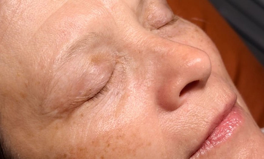 Image 3: Relax with One, Two, or Three 60-Minute HydraFacial Sessions
