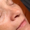 Image 3: Relax with One, Two, or Three 60-Minute HydraFacial Sessions