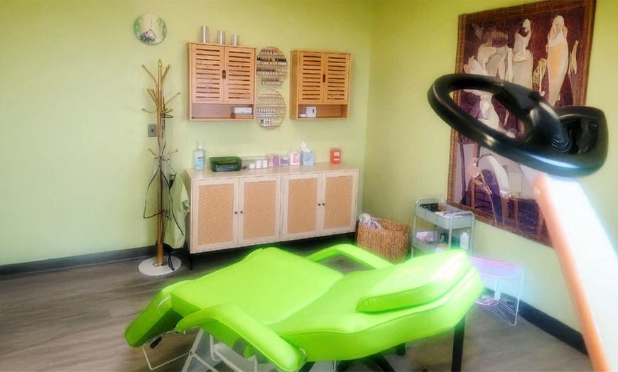 Image 3: Revitalize Your Skin with 1,3, or 5 45-Min Microneedling Sessions
