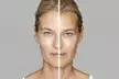 Revitalize with One Lumecca IPL Session for Full Face, Face and Neck or Face, Neck, and Chest ( Up to 47% Off ) - Second Medium