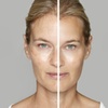Image 3: Lumecca IPL Session for Full Face, Face and Neck or Face, Neck & Chest