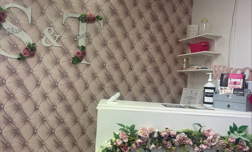 Image 6: Gel Fingers or Toes