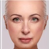 Image 1: Get One, Two, or Three Microcurrent Facelift Treatments
