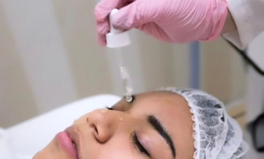 Image 3: Depilación láser, peeling Hollywood y láser de picosegundos 