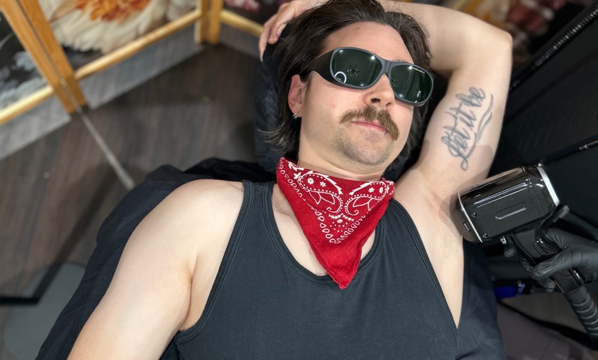 Image 1: 1 oder 3 Laserbehandlungen einer kleinen, mittleren oder großen Zone