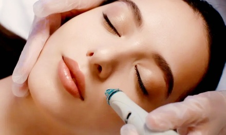 Micro-Needling + Mesotherapy Treatment - Lotus Spa Body Image