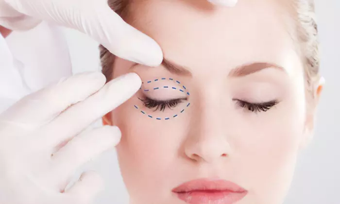 Sesión de blefaroplastia en párpados, ojeras o ambos con jet plasma para 1 persona, con hasta un 71% de descuento - Primary Image