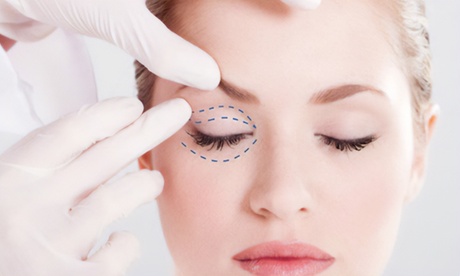 Null Unisex 1 Sesión De Blefaroplastia Con Jet Plasma En Ambos Párpados