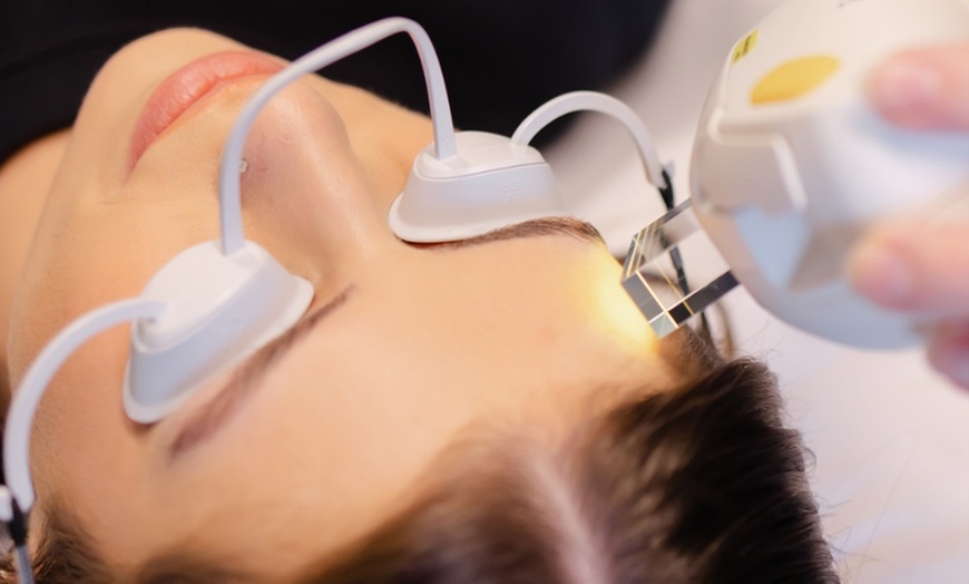 Image 4: Rejuvenate your skin with advanced IPL treatments for a radiant glow!
