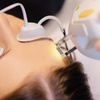 Image 4: Rejuvenate your skin with advanced IPL treatments for a radiant glow!