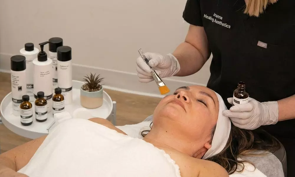 Transform Your Skin with One Medical-Grade Chemical Peel - Face & Neck  at Healing Aesthetics - Up to 50% Off