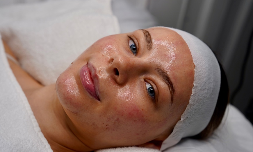 Image 1: Reveal Fresh Skin with One Dermaplane Facial Treatment
