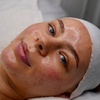Image 1: Reveal Fresh Skin with One Dermaplane Facial Treatment
