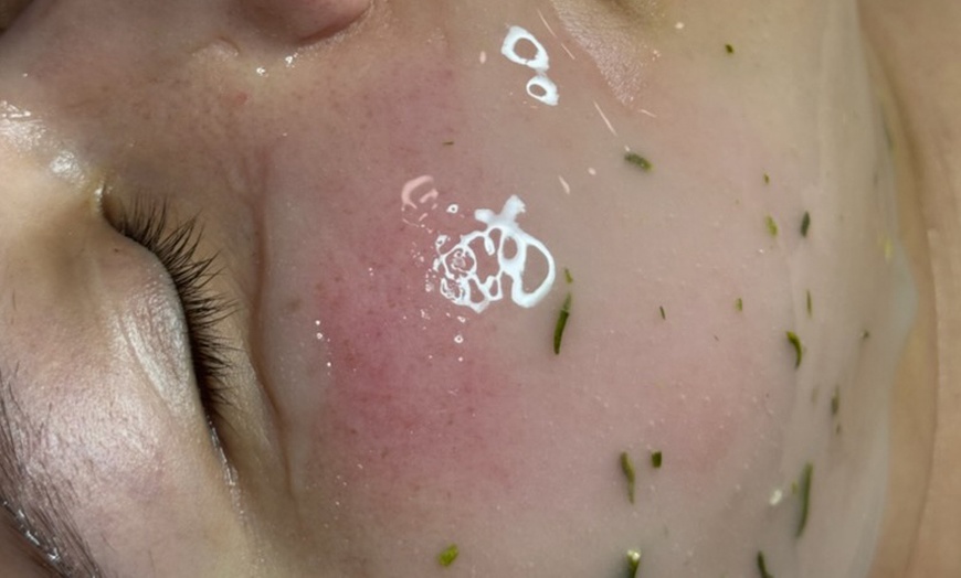 Image 5: Relax with One, Two, or Three 60-Minute HydraFacial Sessions