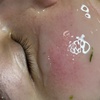 Image 5: Relax with One, Two, or Three 60-Minute HydraFacial Sessions