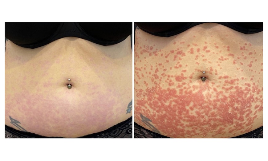 Image 5: Choose Medical Dermalux MD Triwave LED Light Therapy Pak of 10 or 20 