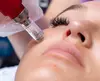 Experience Glowing Skin with 1,2 or 4 PRP Facial Treatments with Micro-Needling at Jeune MedSpa Up To 73% 