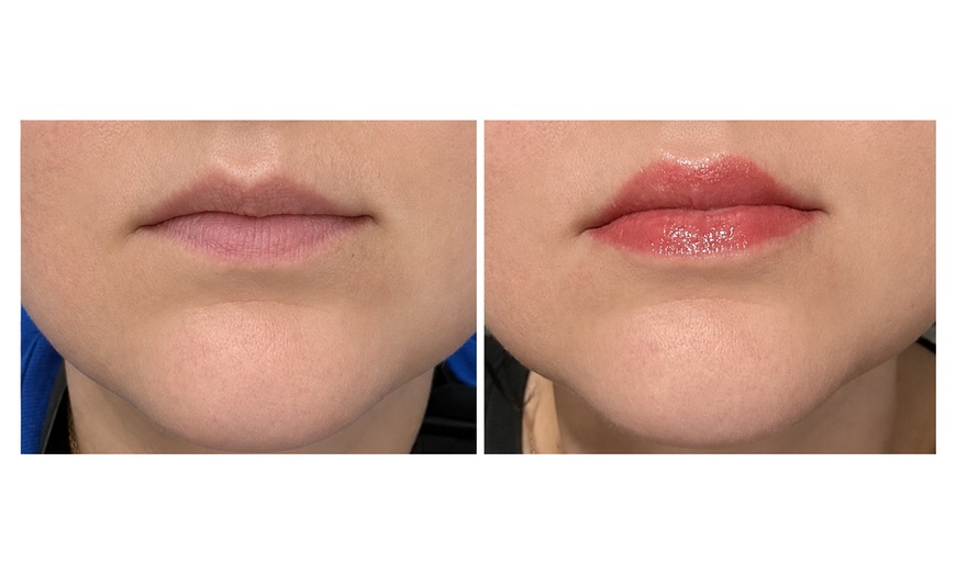 Image 2: Semi-Permanent Lip Blush Service for a Soft, Subtle Tint